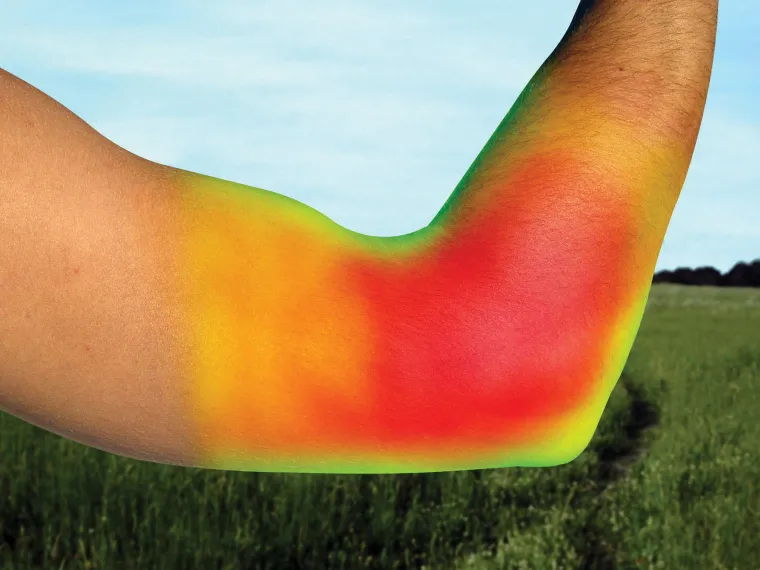 back-on-track-elbow-brace-uCImRBES-2.webp Fashion BACK ON TRACK BOT LL Back On Track® Elbow Brace Black